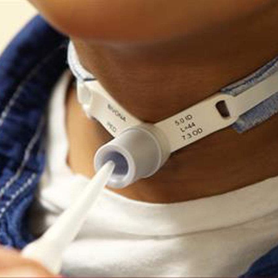 Postoperative Care